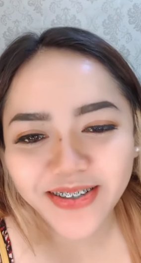 myG #z9ONYO9W