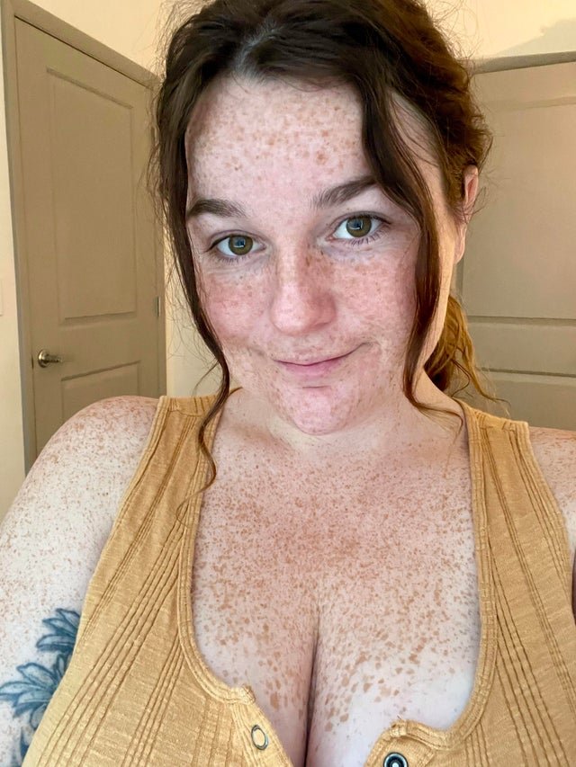 Freckled beauties #VFRZ3rBy