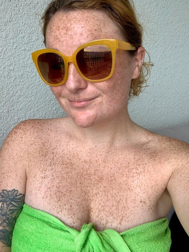 Freckled beauties #cJIrNHhO